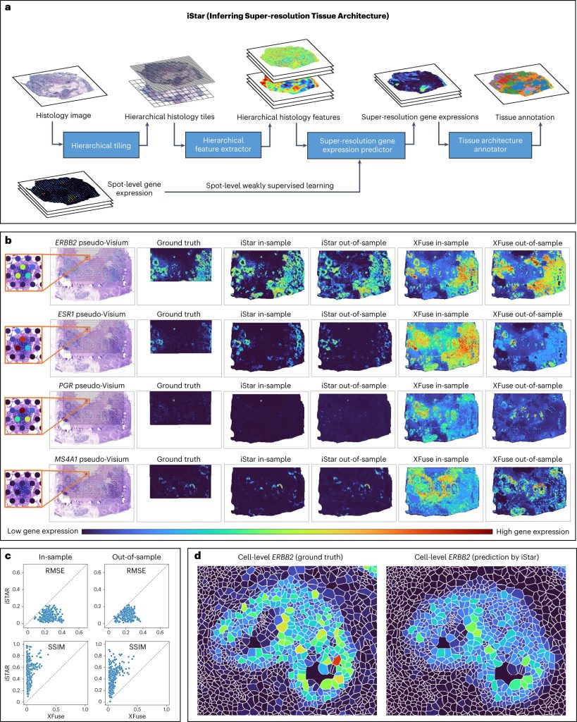 Το νέο εργαλείο τεχνητής νοημοσύνης φέρνει την παθολογία ακριβείας για τον καρκίνο και όχι μόνο σε πιο γρήγορη και ευκρινή εστίαση Το νέο εργαλείο τεχνητής νοημοσύνης φέρνει την παθολογία ακριβείας για.jpg